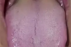 门诊舌象案例：脾虚湿盛，湿热下注，阳气不足，寒湿严重图片