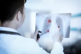 为何谈“磨玻璃”色变？体检查出磨玻璃如何应对？图片