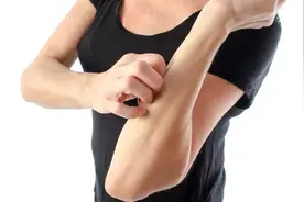 皮肤总是痒是疾病信号？医生：这5种疾病，要注意，小心“中枪”图片