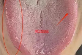 经常早醒失眠的人，多是肝不好，3个中成药，清肝泻肝，专治失眠图片
