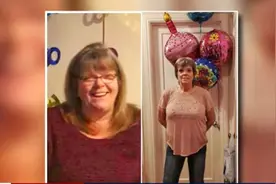 美国女子减肥后做切除赘皮，却被强制做丰胸美臀？后续更离谱！图片