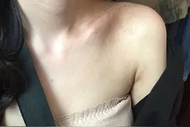王乐君自曝被胡歌砸断锁骨，手术打七根钢钉，剧组封口不让外传！图片