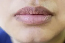 嘴唇开裂，还老是想喝水，千万不要以为只是缺水，可能是这些原因图片