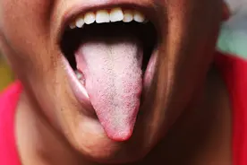 抒发阳气的四逆散！治好心动过速，中医就是这么“没道理”图片