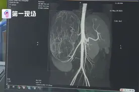 17岁女孩试衣时店员看出端倪，去医院检查后发现体内藏着“巨大肿瘤”图片