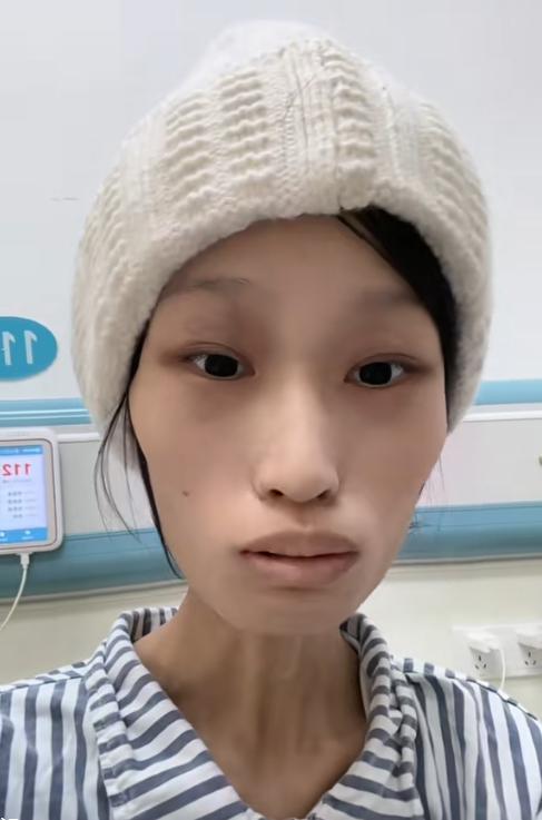 广东“天使女孩”梁希怡去世，仅21岁，生前被误诊，生日当天截肢