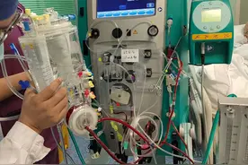 连续性肾脏替代治疗（CRRT）：医学领域的一颗璀璨明珠图片