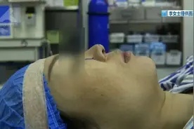 “填了假体又取出，我的鼻子还不如从前了……”图片