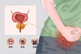 房事后，为什么会排尿困难，尿痛，是前列腺出现问题了么图片