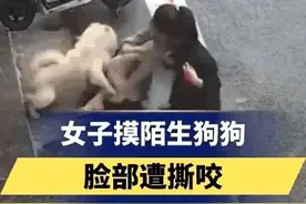 手欠的下场，也是爱狗的下场，经历了这次被咬女子再也爱不起来了图片