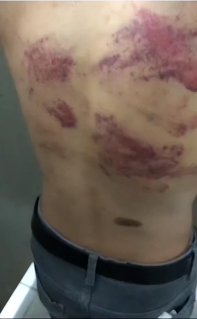 21岁小伙被骗至缅甸妙瓦底近1年，因无法完成“百万美金”业绩遭殴打，父亲：已获救