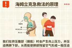 异物卡喉急救知识大全图片