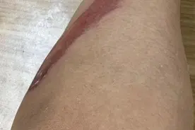 遍体鳞伤！万元电动自行车刹车失灵，上海男子“飞出5米远”！更心寒的是图片