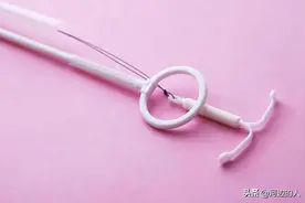 中国第一批“上环”的女性，30年后现状如何？医生：难逃4种结局图片