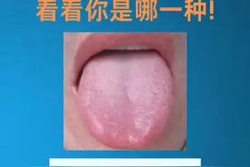 九种常见的体质舌象 看看你是哪一种？图片