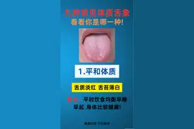 九种常见的体质舌象 看看你是哪一种？图片