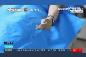 气死人是可能发生的#！女子吵架后手僵硬竟是气中毒了图片