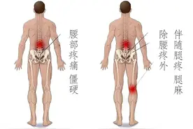腰突与腰肌劳损别傻傻分不清楚，一篇文章教你分清两者的区别图片
