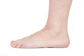 跟腱断裂后怎么治疗呢？图片