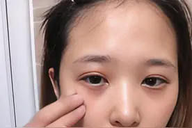 《说文解字》第843课：古汉语中“肿”和“痈”的区别图片