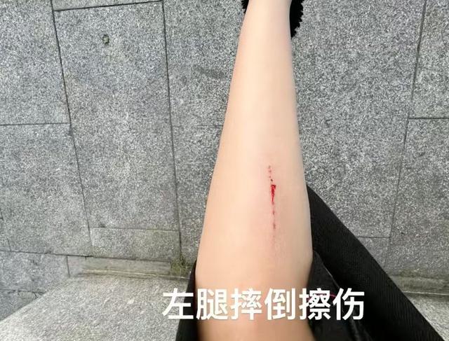 短剧女演员被男主一脚踹飞，指甲当场断裂，贾玲的话又一次应验了