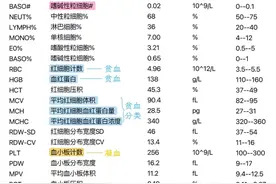 血常规报告单图片