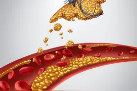 长期吃他汀，吃半年停半年可以吗？坦言：这么做可能会后悔莫及图片