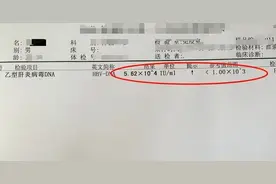 乙肝发展为肝硬化，多数是这点没做到！图片