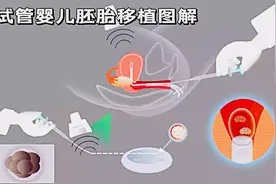做试管婴儿，胚胎移植是不是随便哪天都能进行？可没有那么简单！图片