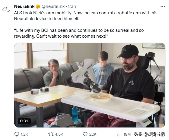 A股:脑机接口重磅消息，渐冻症患者独立进食、喝水，明天莫要恐慌