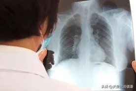 27岁她肺结节做手术，术后半年还有肋间神经痛，感觉气短喘不过气图片