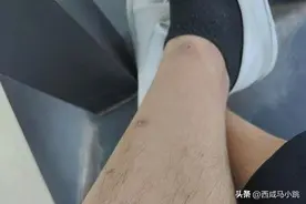 开电车2年，腿毛掉完了？图片