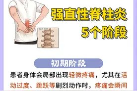 强直性脊柱炎，5个阶段，希望你永远到不了4和5阶段图片