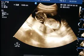 家有两宝一男一女，分享怀儿子和怀女儿的时候孕期的反应有何不同图片