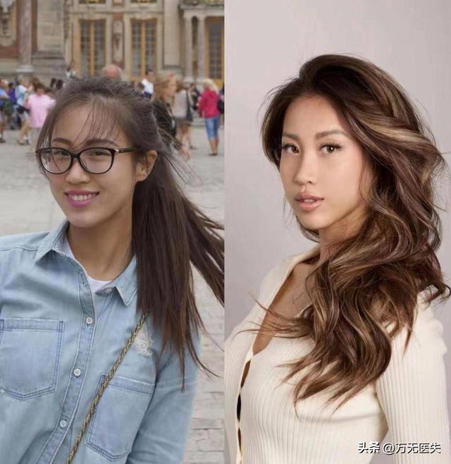 留学一年嘴都变大了，女学生面相变化图走红	，牢A果然权威