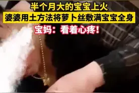 半个月的宝宝上火，婆婆用萝卜丝敷满宝宝全身：这事，不是第一次图片