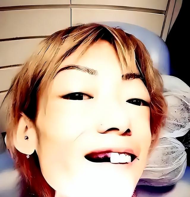 一代女神沦为豪门玩物？结婚8年牙齿全掉，器官切除，面似骷髅