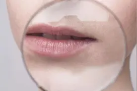 嘴唇有2个迹象，血脂或已超标，这是真的吗？听听医生怎么说图片