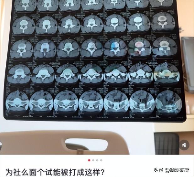 面试被打后续：警方出手，更多受害者站出来，老板身份越扒越可怕