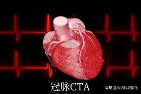 冠脉CTA提示冠脉有狭窄，需要做冠脉造影吗？|答患者问图片