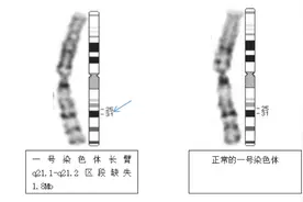 为啥要做染色体检查？多一点少一点，后果都会很严重......图片