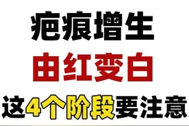 疤痕增生从红到白的3个阶段，如果出现这个现象一定要注意！图片
