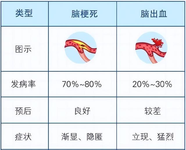 脑梗高发季 有3种不舒服千万别大意