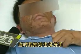 已接诊多例！重庆多人中招，毒液堪比“硫酸”图片