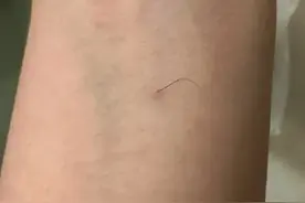 为啥人身上总有几根特立独行的毛？在错误的地方努力突出图片