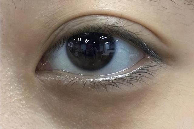 女人有没有妇科病，看脸就知道？脸上有几种表现，说明你要当心了