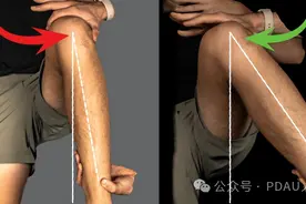 【PDAU康复前沿】想要身体稳定？髋内旋角度至关重要！图片