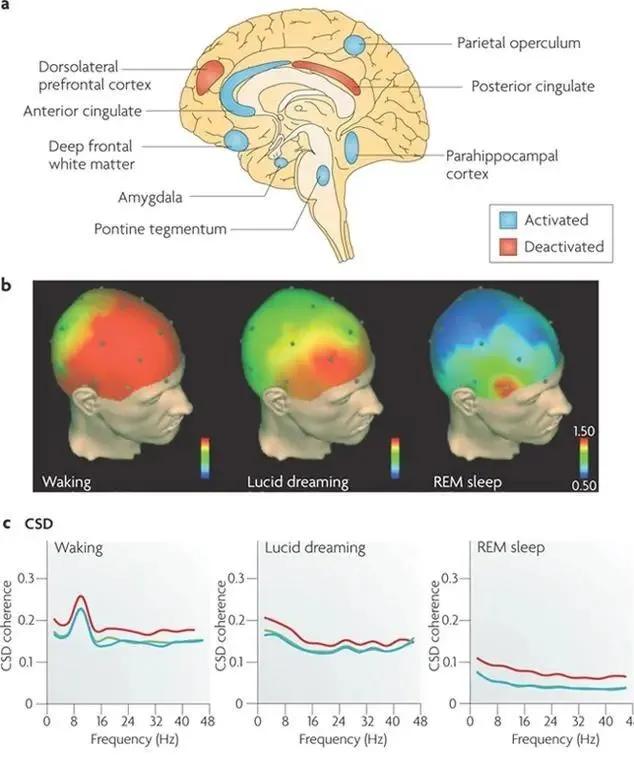 我们睡觉时的梦境,为什么总是乱七八糟,甚至毫无逻辑?