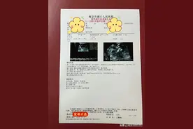 孕12周，来做NT检查啦图片