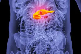 恶性肿瘤胰腺癌生存期超5年，实现患者利益最大化！图片